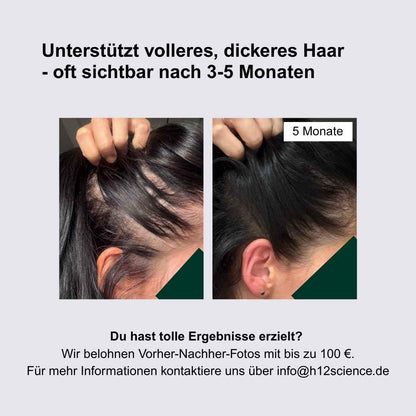 Haardichte-Komplex