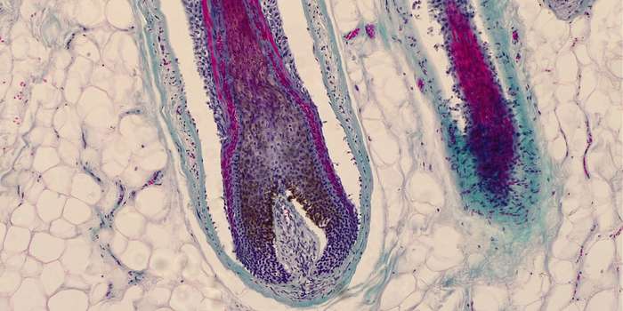 Mikroskopischer Histologie-Schnitt einer aktiven Haarwurzel und Haarfollikel-Struktur in der Haut